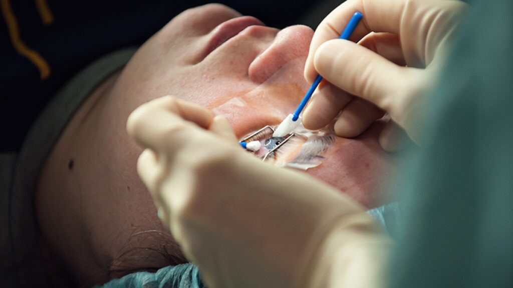 Cost of Laser Eye Surgery