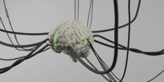A computer generated image of a brain surrounded by wires