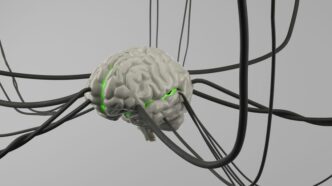 A computer generated image of a brain surrounded by wires
