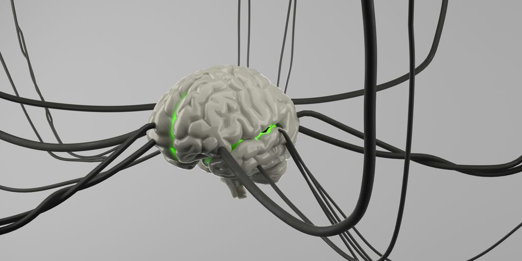 A computer generated image of a brain surrounded by wires