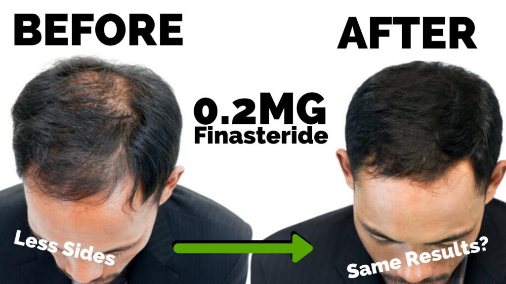 Finestrad