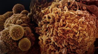 a close up of a bunch of brown and yellow stuff