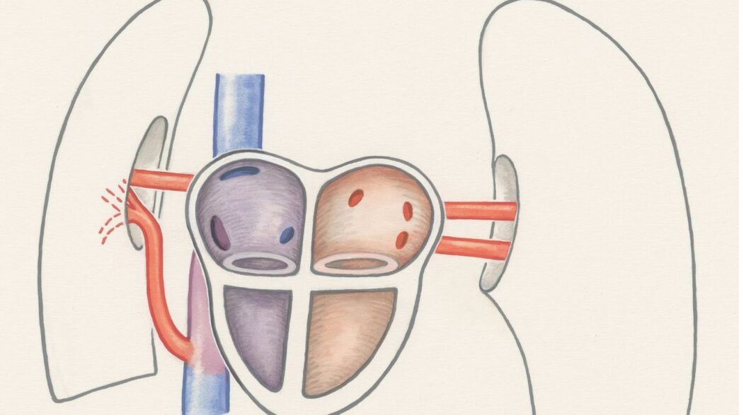 a drawing of a diagram of the kidney