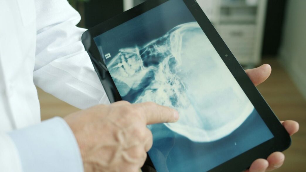 Doctor pointing at x-ray on tablet screen