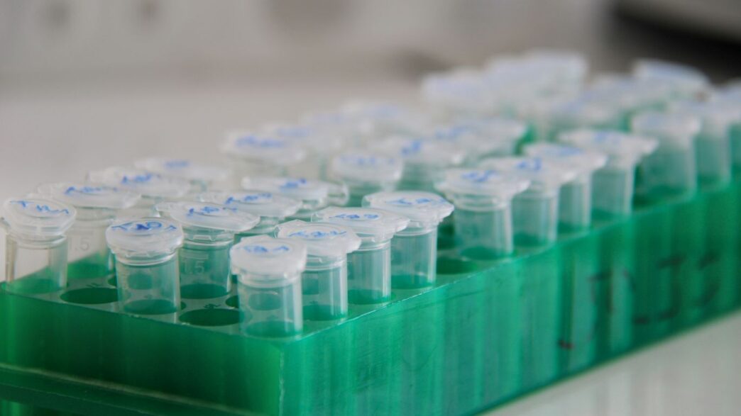 Rows of lab tubes sit in a tray.