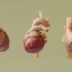 Three anatomical models of human hearts are shown.