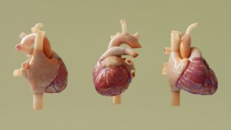 Three anatomical models of human hearts are shown.
