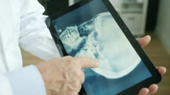 Doctor pointing at x-ray on tablet screen