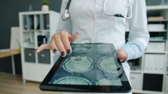 Doctor shows brain scan on tablet in office
