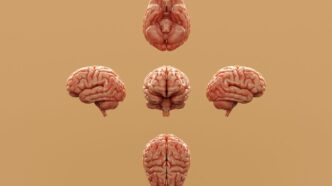 Various perspectives of a human brain are displayed.