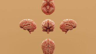 Various perspectives of a human brain are displayed.